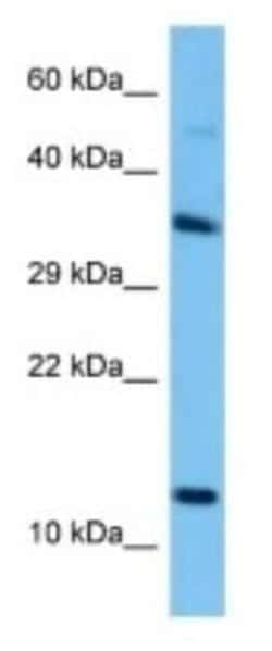 Svs5 Rabbit anti-Rat, Polyclonal, Novus Biologicals 100 &mu;g | Buy Online | Novus Biologicals | Fisher Scientific